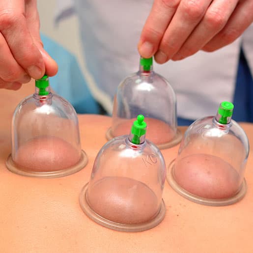 Dry Cupping Therapy (दीपयंत्र)
