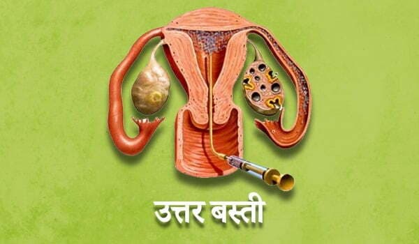 Ayurveda for PCOS: Natural Hormonal Balance Without Side Effects